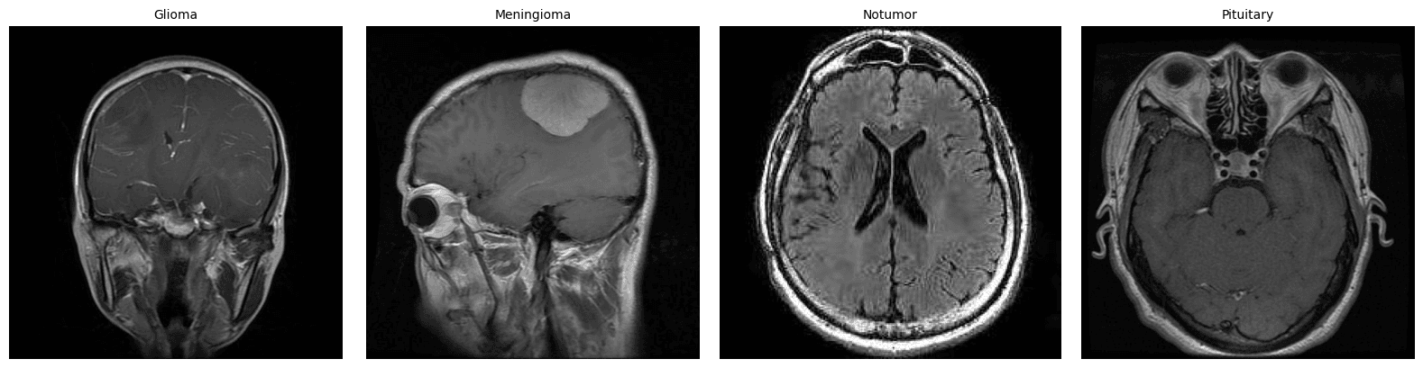 Comparative Analysis of CNN Architectures for Brain Tumour Classification