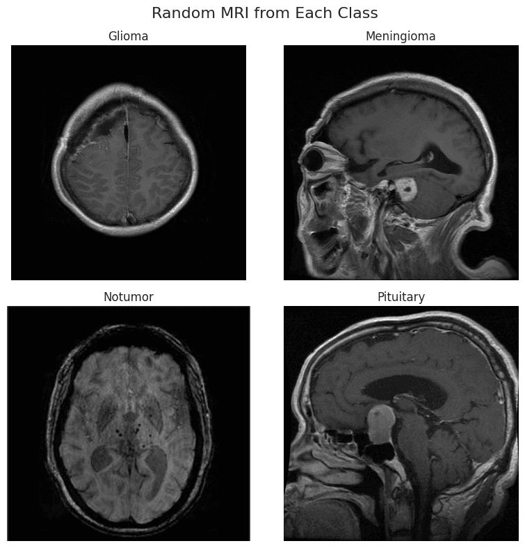 Comparative Analysis of CNN Architectures for Brain Tumour Classification