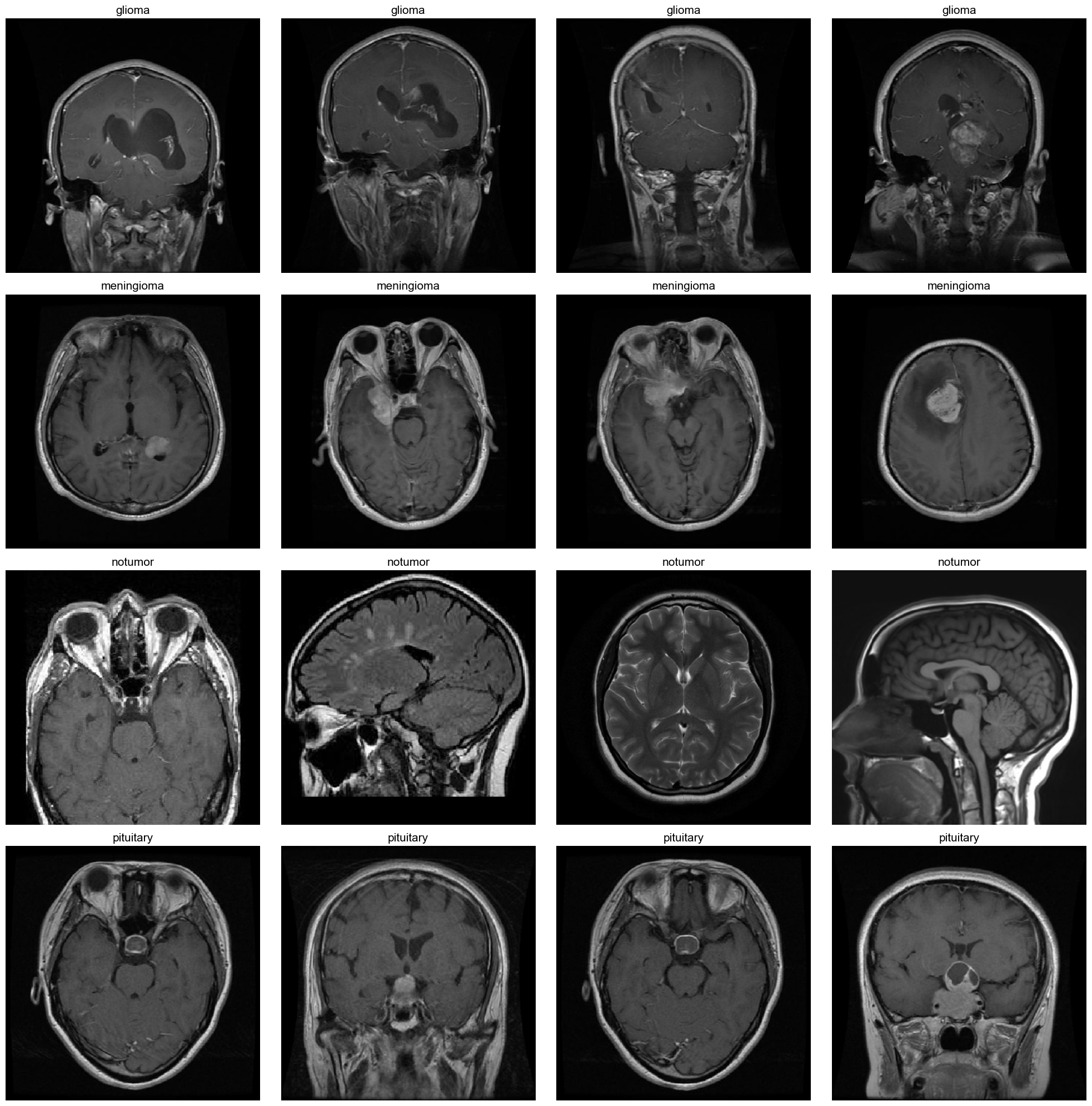 Grid of 4x4 brain MRI scans